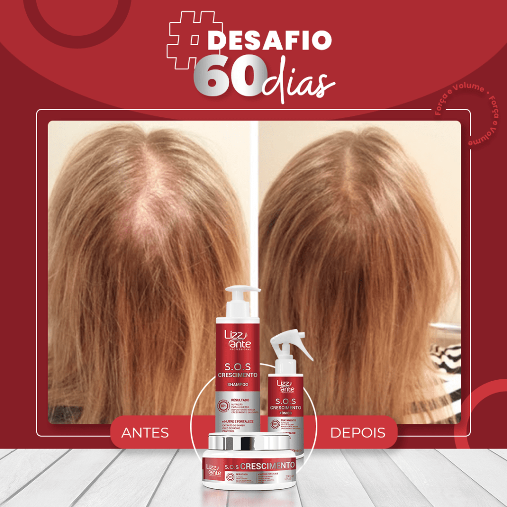 Kit S.O.S Crescimento Crescimento Capilar Curso diário - DIcas