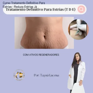 Curso Tratamento Definitivo Para Estrias – Reduza Estrias Já