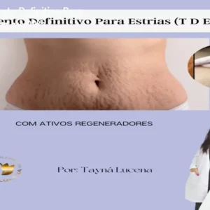 Curso Tratamento Definitivo Para Estrias – Reduza até 98%