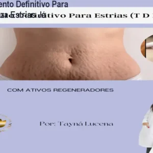 Curso Tratamento Definitivo Para Estrias – Reduza Estrias Já