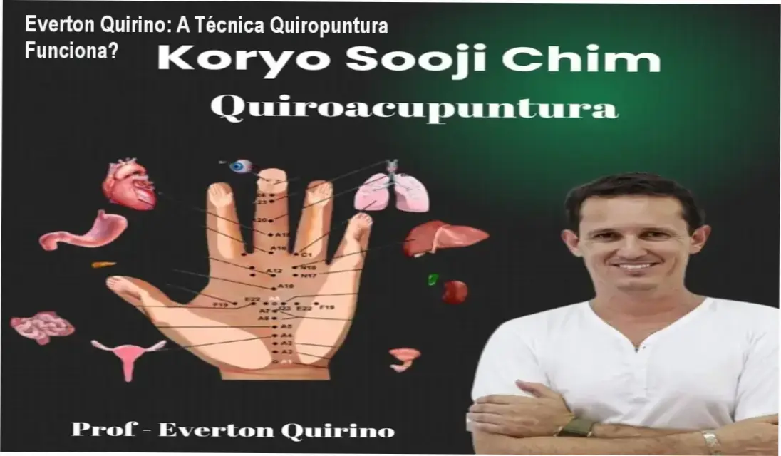 Aplicação da técnica Quiropuntura Koryo Sooji de Everton Quirino em pontos reflexológicos da mão