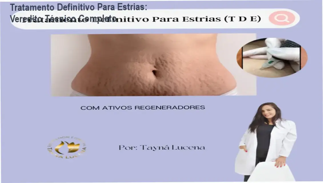 Tratamento Definitivo Para Estrias: Veredito Técnico Completo 1 Aplicação de técnica de regeneração dérmica para tratamento de estrias